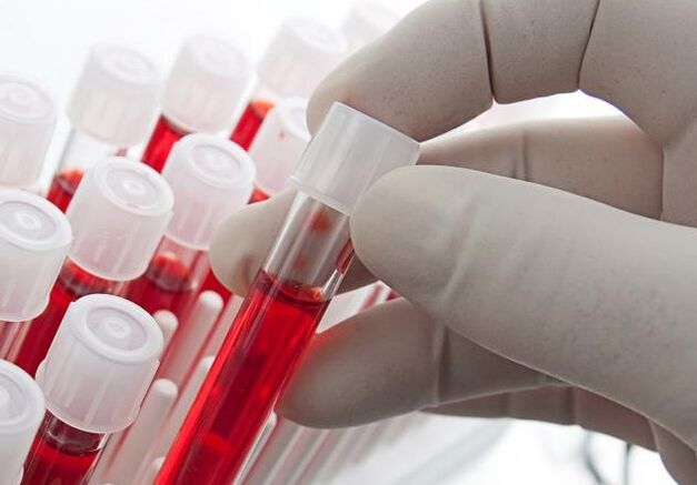 Analisi del sangue dopo aver bevuto alcolici